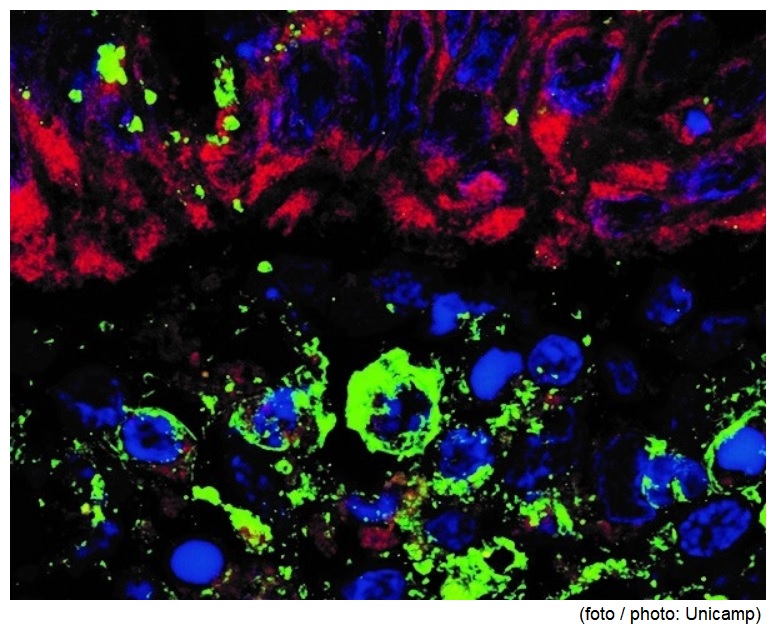 High-fiber diet may play a role in controlling the inflammation associated with COVID-19