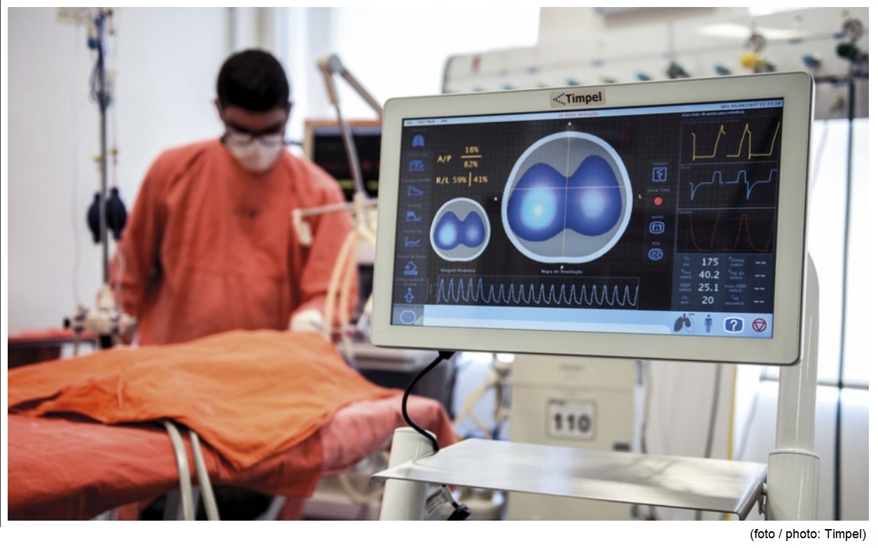 Technology reduces need for extracorporeal ventilation in patients with acute respiratory failure by 80%
