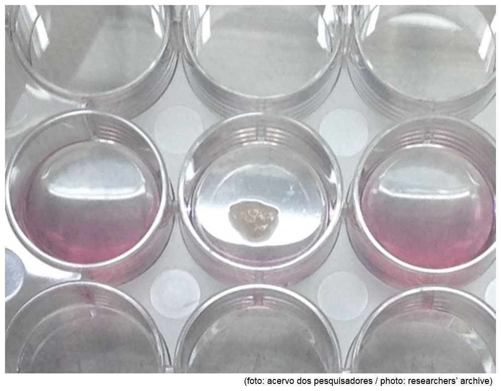 Study assesses use of stem cells to treat knee injuries