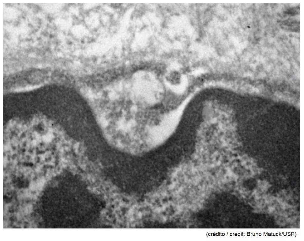 Novo coronavírus infecta e se replica em células das glândulas salivares