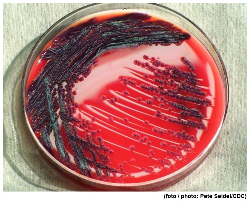 Opportunistic bacterium increases its virulence by ‘poaching’ zinc and iron from hosts