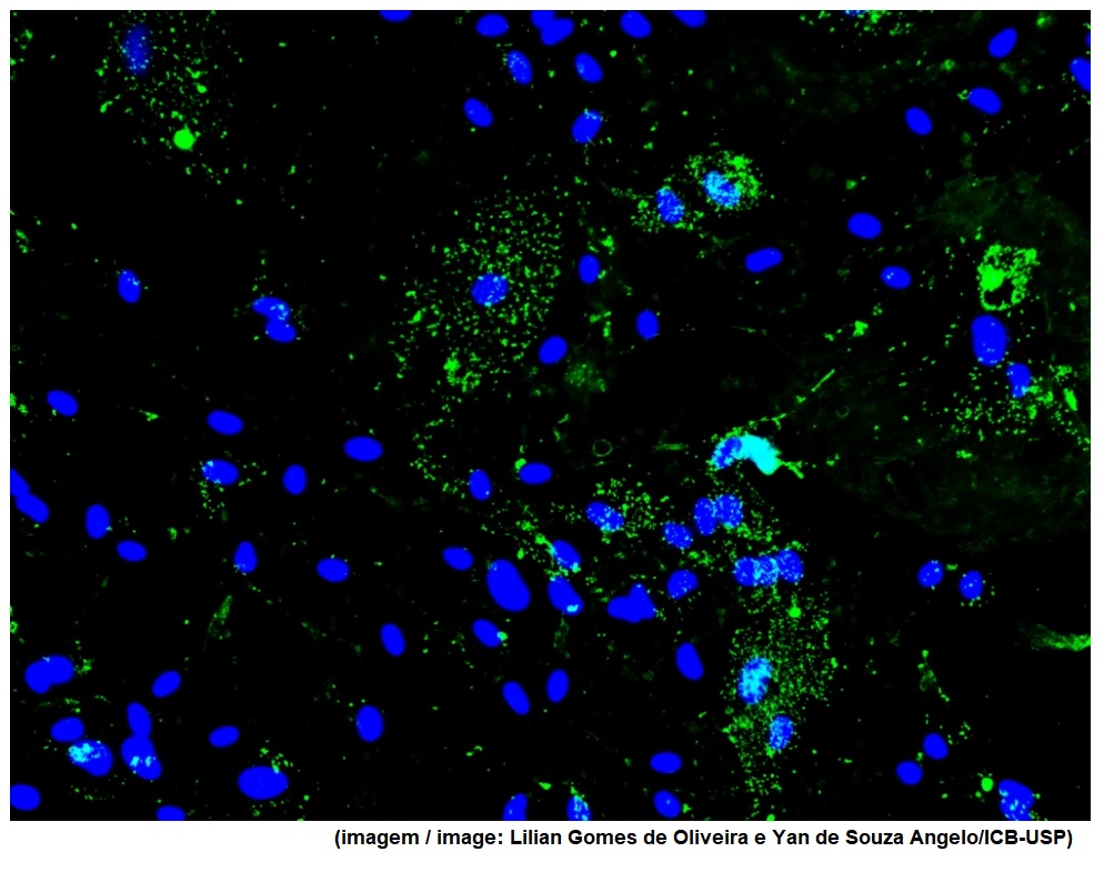 SARS-CoV-2 increases brain cell energy expenditure in order to replicate